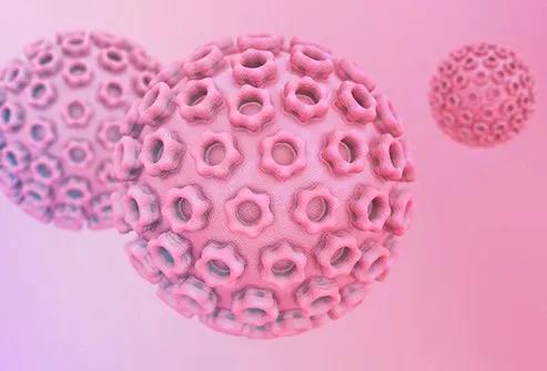 Ilustratie medicala reprezentativa pentru herpes genital