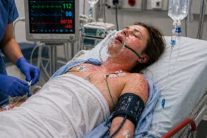 soc anafilactic pacient cu reactie alergica severa eruptii cutanate dificultate respiratorie monitorizare medicala si perfuzii in spital imagine realista